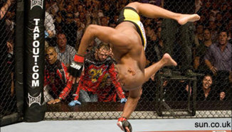 Chael Sonnen сравни Anderson Silva с животно родено с увреждания