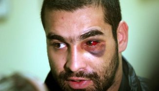 Изписаха Багата от „Пирогов”