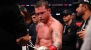 Канело Алварес аут до средата на 2026 след тежка операция